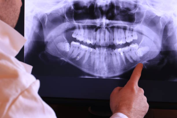 Best Urgent Tooth Repair  in Raynham Center, MA